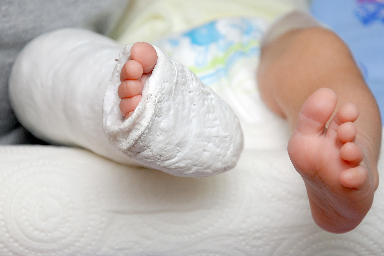 Child with bandage around foot